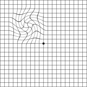 Distorted Amsler grid